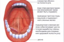 венците възпаление венците
