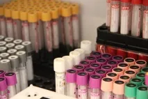 КВД - вартість аналізу на сифіліс у Новосибірську аналізу