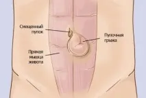вагітності