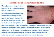 Багатоформна ексудативна еритема - фото та лікування хвороби фото