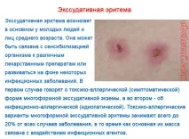 Багатоформна ексудативна еритема - фото та лікування хвороби фото