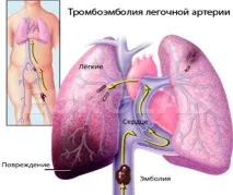 Причини та лікування болю при глибокому вдиху у правому підребер’ї причини