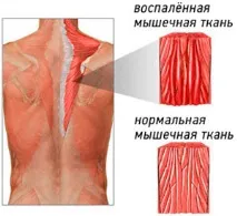 Причини та лікування болю при глибокому вдиху у правому підребер’ї болю