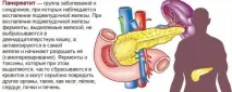панкреатит причини