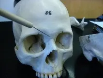 кістка