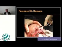 белег сечение