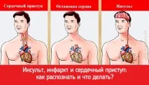 удар инсулт