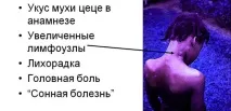 Сонна хвороба (африканський трипаносомоз) симптоми, збудник трипаносомоз