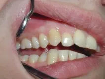 лікування