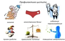 Свічки від циститу Список ефективних засобів хвороби