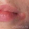 причините причините