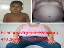 правя иценко-кушинг