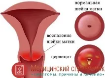 симптоми