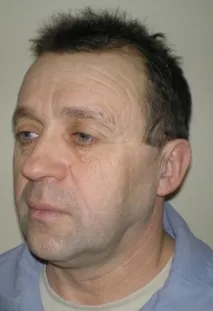 Центр Хірургічної Косметології операції