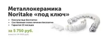 Бюгельний протез із замками від мережі клінік А-медик бюгельний
