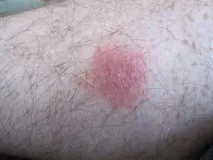 кожата кожата
