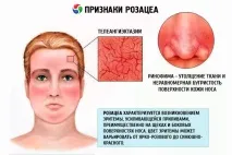 диета розацея