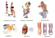 артрозі