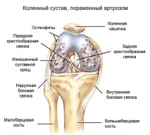 бубновського