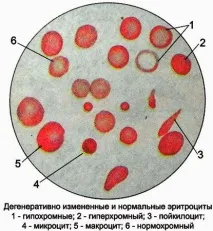 тест хипохромия
