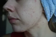 Сироватка з екстрактом Галактомісісу (GALACTOMYCES 100) Ramosu -Корея екстрактом