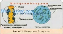 Клініка дерматомікозів клініка