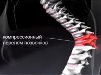 лечение рехабилитация