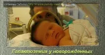 новонароджених