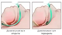 операцията ефективност