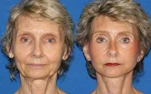 lucerin крем