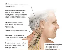 Остеохондроз шийного відділу – причини, симптоми, лікування шийного