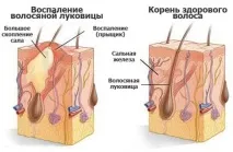 защо главата