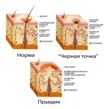 главата лечение