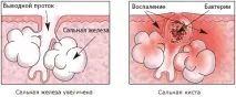 голові