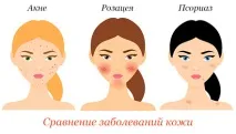 харчування