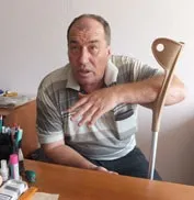 протеза някаква причина