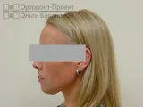 проблеми