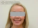 проблеми