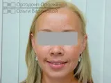 вирішення