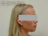 сепарація