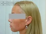 сепарація