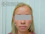 вирішення