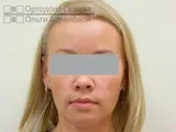 сепарація