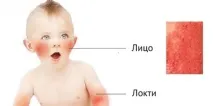 обличчі