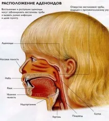 пъти дневно аденоиди деца