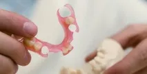зъбното цената