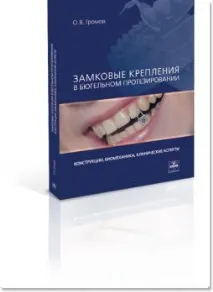 аспекти брави