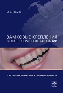 протезиране закопчалка