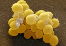 aureus гърлото