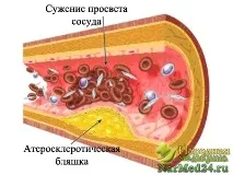 характерни симптоми